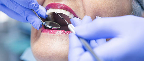 Best Emergency Wisdom Teeth Removal in New Richmond, OH